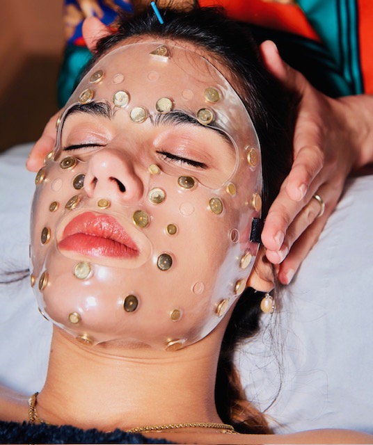 meilleur aculifting rennes acupuncteur