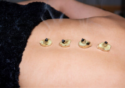 moxibustion rennes