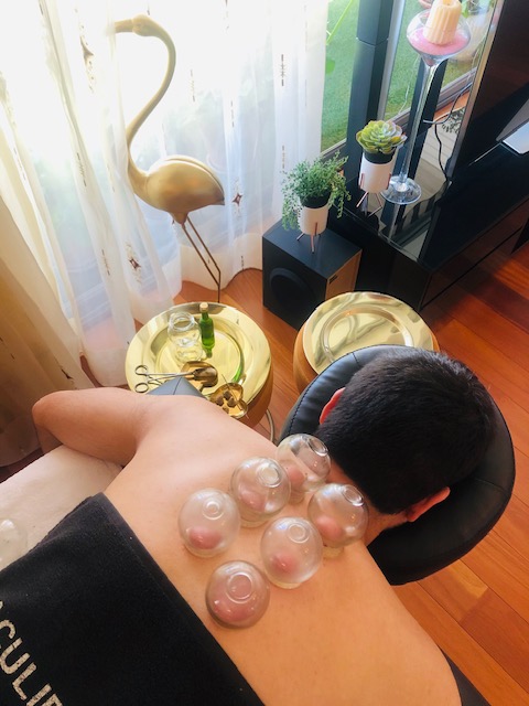 ventouses medecine chinoise rennes