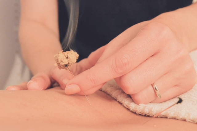 sophie hourtach rennes acupuncture