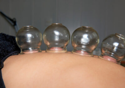 acupuncture medecine chinoise rennes