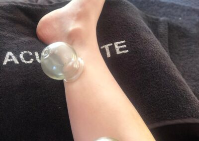 ventouses sophie hourtach rennes