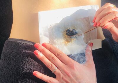 meilleur acupunctrice rennes sophie hourtach