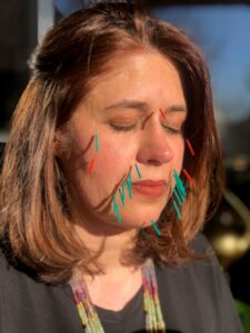 ACUPUNCTURE VISAGE LIFTING